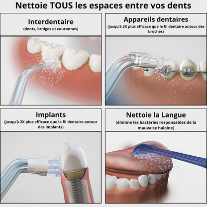 Jet Dentaire Rechargeable pour un Sourire Éclatant