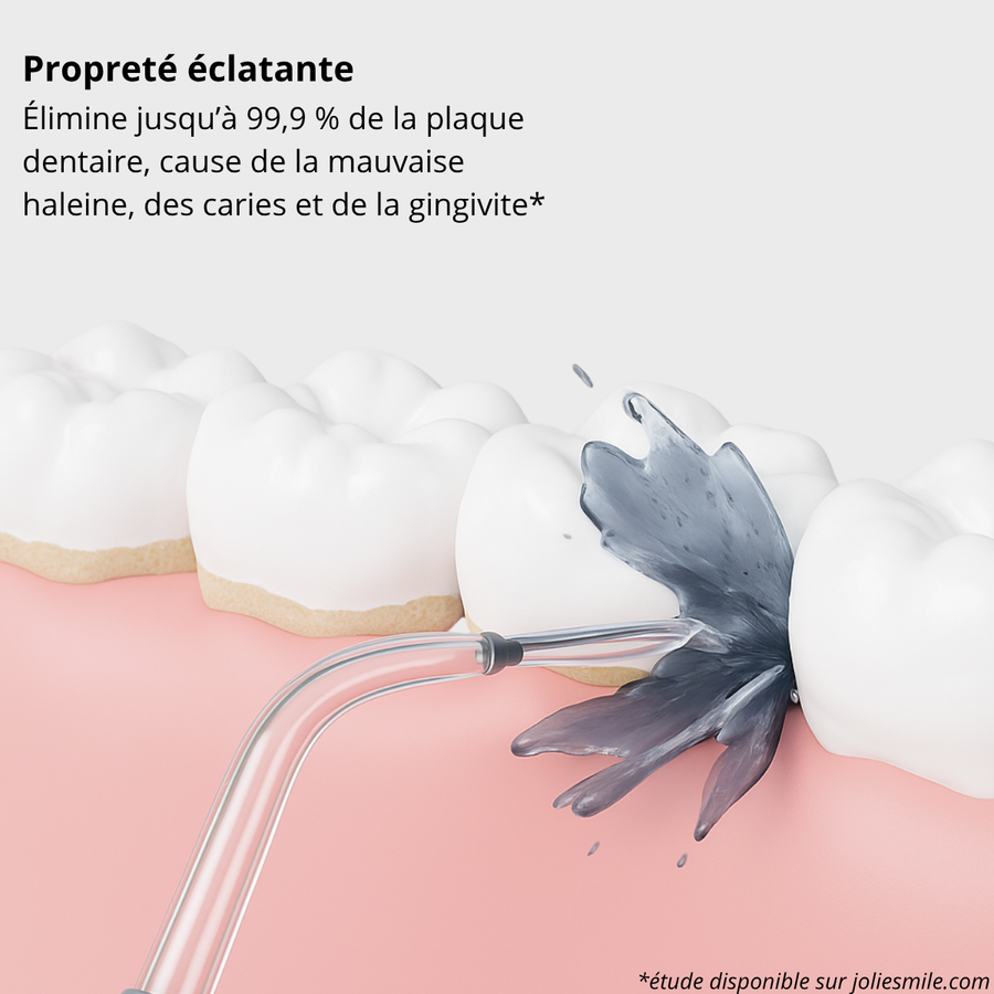 Jet Dentaire Rechargeable pour un Sourire Éclatant
